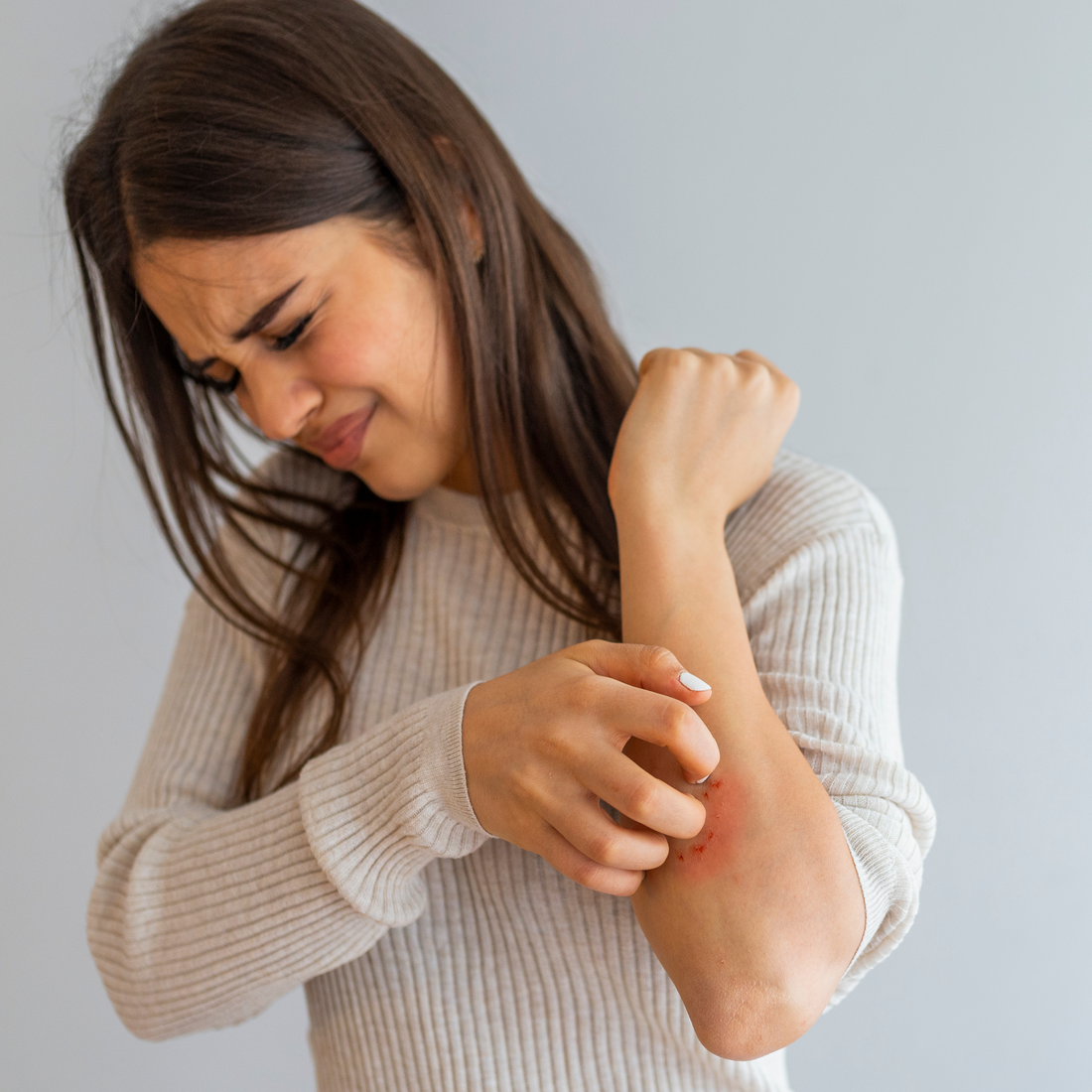 Eczema: Understanding Causes, Symptoms, and Treatments